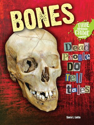 cover image of Bones